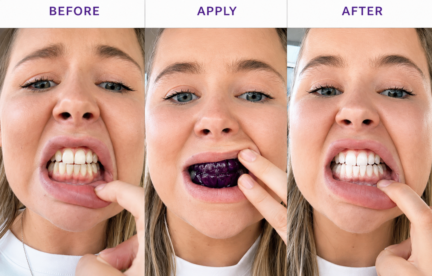 Purple PAP Whitening Strips